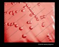 listeria monocytogenes